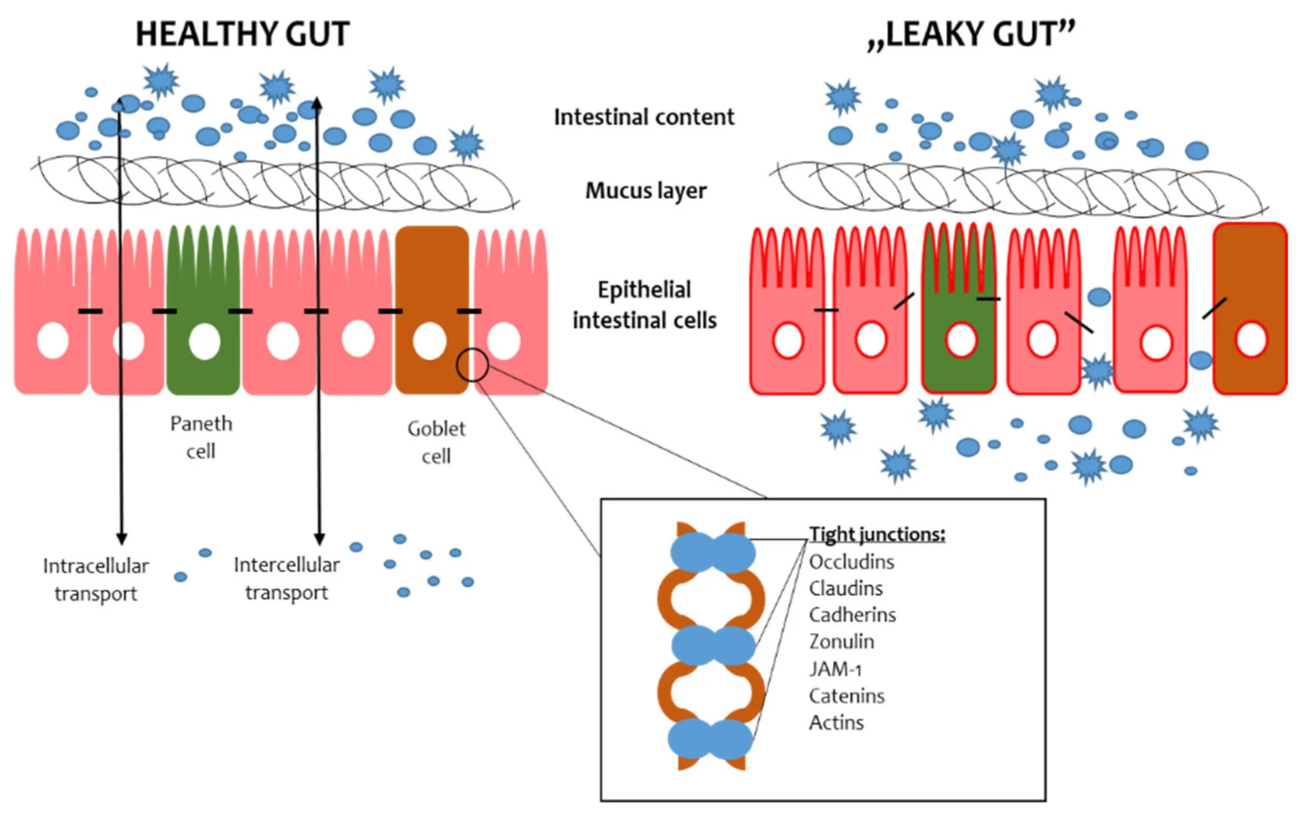 Common leaky gut symptoms